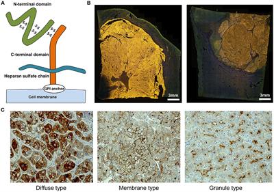 Next-Generation Cancer Immunotherapy Targeting Glypican-3